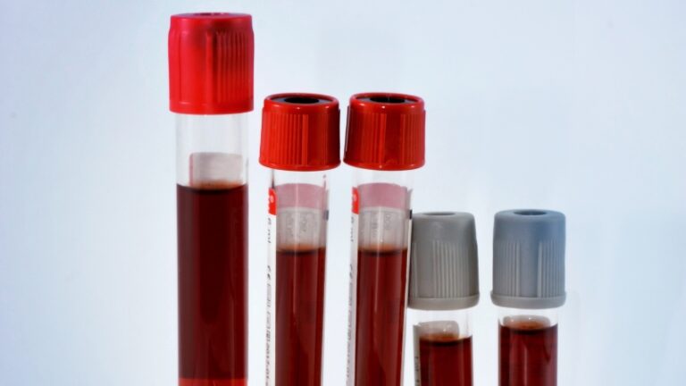 Blood samples in test tubes used for determining blood type in laboratory analysis