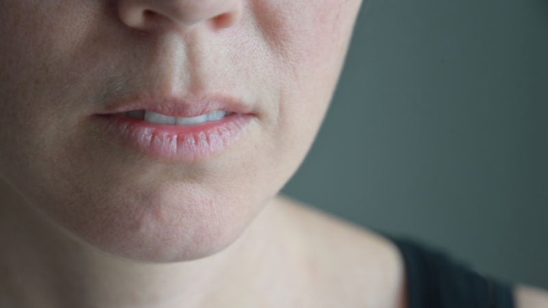 Person with dry lips and slightly open mouth, showing signs of nighttime dry mouth